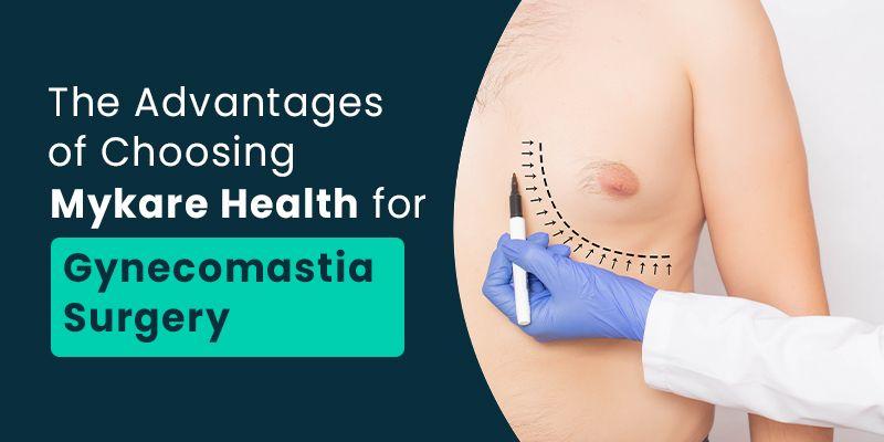 Advantages of Gynecomastia Surgery